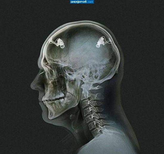 А зубы где?