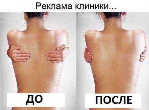 Укорачиваем руки!
